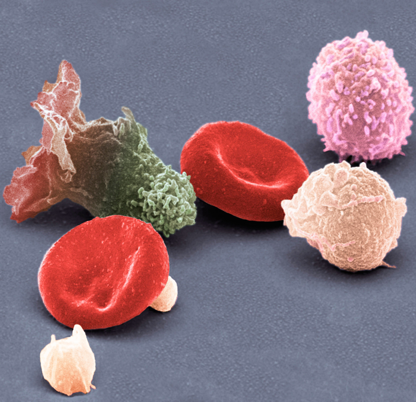 Magnification view of human blood cells under a Color scanning electron micrograph